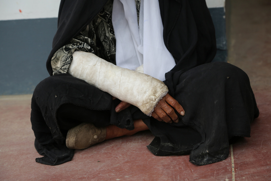 Emergency Hospital in Afghanistan.

Babo 60 years old, she was hit by a shrapnel fired by Afghan government forces during a fight with Taliban in Marjah district of Helmand.

Now she is being treated in the Emergency hospital in Lashkargah.