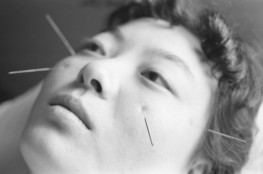 Acupuncture in China

In China, acupuncture is a routinely accepted part of medical practice.
