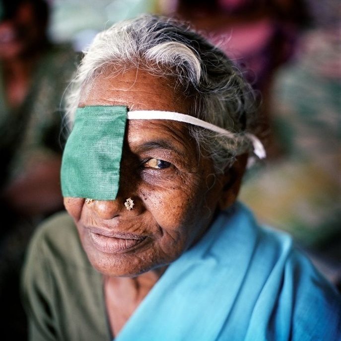 This particular feature presents Kuzhanthiammal, 67, who regained her vision after free cataract surgery at Aravind Eye Hospital in Madurai, India. She wears a patch on one eye while recovering from cataract surgery. 

Soon after the first symptoms appeared, Kuzhanthiammal heard of an eye diagnostic camp that was taking place at a nearby village. She decided to attend, and within a few minutes was diagnosed and registered for free cataract surgery at the Madwai Aravind Eye Hospital the following week.
The programme even covered transport costs. “A bus picked me up with seven other cataract patients and drove us to the hospital,” she says. Some 70% of Aravind’s eye patients are charity cases; the 30% who are paying customers support these free sight-restoring operations. The hospital also sells abroad three quarters of the lenses it produces, to help finance its activities.
Now 67 years old, Kuzhanthiammal successfully underwent surgery on her other eye a few months ago. “These artificial lenses are a miracle. It’s like waking up with your problems gone,” she joyfully explains.

This series of photos showcases stories of people from different countries living with chronic diseases and common underlying risks. In a world where more and more people are dying as a result of chronic diseases, and many more millions are disabled, these stories aim to demonstrate the strong and personal impact of chronic diseases on individuals and their families.