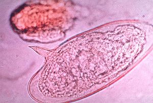 esporoquiste de esquistosoma mansoni