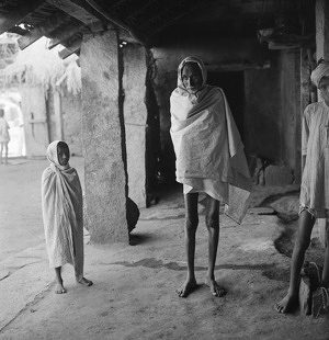 India against the bad cough - In 1959, India had over 5 million cases of tuberculosis. Two thirds of her population were carriers of virulent tuberculosis bacilli. By systematically vaccinating the rising generation and with the help of chemotherapy, India was hoping gradually to redress the balance. Mobile X-ray units went from village to village, young sociologists convinced the inhabitants that they should not dissimulate the disease; visiting nurses made sure that the sick followed their treatment. But housing and sanitation sometimes left much to be desired and efforts had to be intensified if the disease was to be brought under control. Our photos show what has been done, with WHO help, in the district of Tumkur, State of Mysore, to fight tuberculosis. Few old people come for examination. Most of them care little for life: they spurn treatment. As carriers of the bacillus, they are a constant danger to the people around them.
