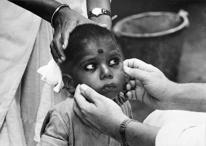 Eyes that need weep no more. In 1959 it was estimated that nearly 400 million people suffered from trachoma. Though this eye infection does not kill, it can last a lifetime if untreated. Its victims often become blind. In India, trachoma was the largest single cause of preventable blindness. In some rural areas of Northern India the infection rate was as high as 80-90 per cent of the total population. A WHO-assisted pilot project trachoma team based at the Gandhi Eye Hospital in Aligarh, Uttar Pradesh, visited the region village by village, examining patients and organizing antibiotic treatment, and carrying out research to determinate the ways in which infection spread. The methods of attack proved effective in preventing blindness but complete control of trachoma and associated bacterial conjunctivitis requires the support of long-term health education and environmental sanitation programmes. The manner of applying eye cosmetics ("kohl") widely in Eastern countries for both woman and children, is suspected to play an important part in spreading eye infections. A mother with infected eyes can easily pass on the infection to her children, or from one infected child to another, while applying cosmetics to her eyes or those of her children with the same finger or "pencil".