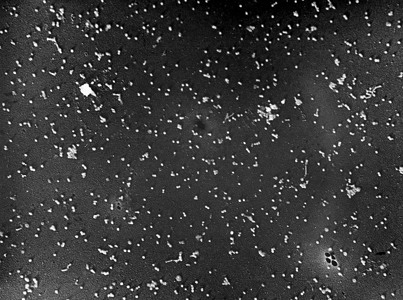 Electron Microscope photograph showing influenza virus. 