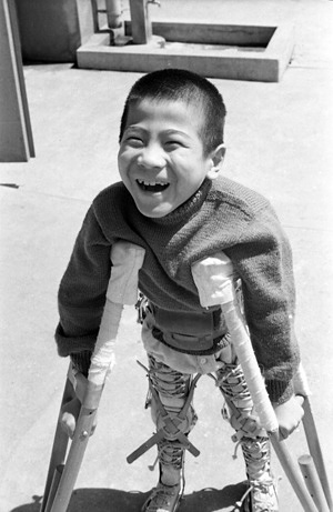Shigenori Kameyama was little more than a year old when the polio virus found him in the hamlet of Tsukuni on Kyushu Island, some 1,800 kms from Tokyo. He became completely paralysed: he could not lift a finger nor wiggle a toe. Undaunted his parents - a humble family of limited means - decided to move to Tokyo where, several years later, Shigenori was admitted to the Seishi Ryogo En, a hospital, school and home for crippled children founded in 1937 by Dr Kenji Takagi, pioneer of rehabilitation work in Japan. There he began the long battle to regain part use of his limbs - just one of many Japanese children who have been helped indirectly by WHO and UNICEF, by the provision of fellowships for Japanese health personnel to go abroad and study the latest methods of rehabilitation. After two years of patient endeavour by Shigenori and his nurses, he manages to make one uncertain step forward on crutches. Then comes triumph! Shigenori manages to hobble forward a distance of five feet.