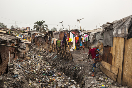 Cholera is an acute enteric infection, primarily linked to insufficient access to safe water and proper sanitation. Pakajuma Slum, one of the first settlements in Kinshasa.