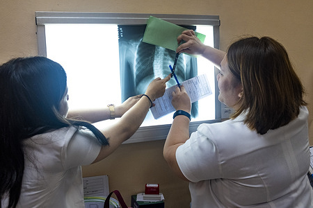 Chelsea Marie (11) during an assessment consultation done by a physiatrist and rehabilitation specialist at the outpatient department of the Philippine General Hospital in Manila. Chelsea Marie was scoliosis.