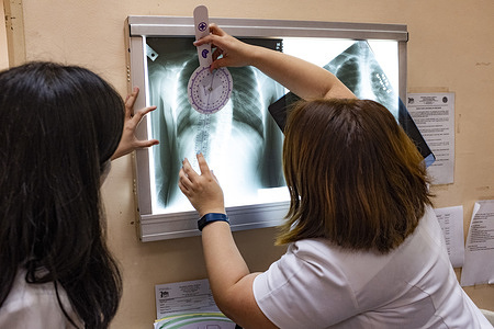 Chelsea Marie (11) during an assessment consultation done by a physiatrist and rehabilitation specialist at the outpatient department of the Philippine General Hospital in Manila. Chelsea Marie was scoliosis.